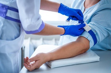 Badanie ASO (odczyn antystreptolizynowy) – wskazania, normy, podwyższone, obniżone