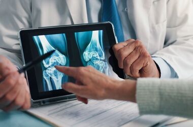 menopauzalna terapia hormonalna, menopauzalna terapia hormonalna zapobiega osteoporozie, osteoporoza widoczna na prześwietleniu