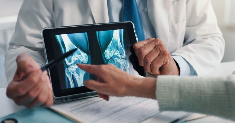 menopauzalna terapia hormonalna, menopauzalna terapia hormonalna zapobiega osteoporozie, osteoporoza widoczna na prześwietleniu