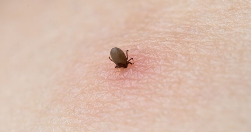 kleszcz, kleszczowe zapalenie mózgu, szczepienie na KZM, kleszcz wbity w skórę