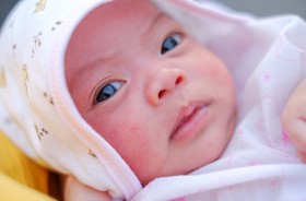 Wysypka u niemowlaka – co może oznaczać?