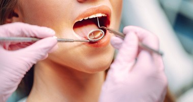 Próchnica między zębami – jak ją wykryć, zapobiegać i leczyć?