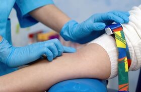 pobranie krwi, badanie poziomu LH