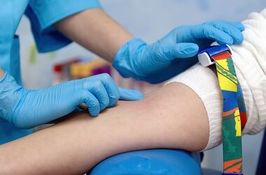 pobranie krwi, badanie poziomu LH