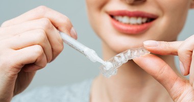 Nakładkowe wybielanie zębów