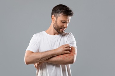 Mężczyzna drapie się po ramionach, mając egzemę