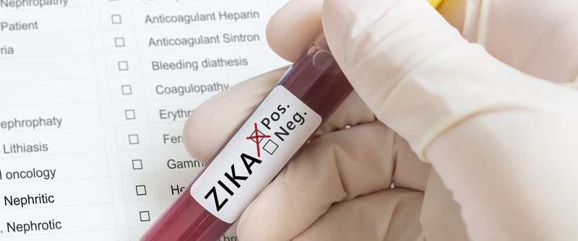 Wirus Zika może pomóc chorym na raka mózgu