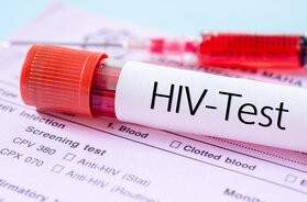 HIV (ludzki wirus niedoboru odporności) – charakterystyka, epidemiologia, transmisja. Objawy i nowoczesne terapie w leczeniu zakażeń wirusem HIV