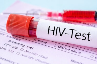 HIV – charakterystyka, epidemiologia, transmisja