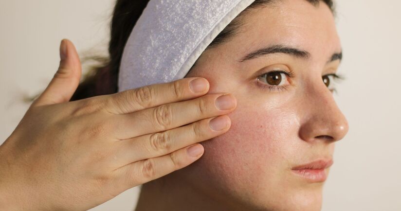 cera wrażliwa, skóra wrażliwa, pielęgnacja skóry wrażliwej