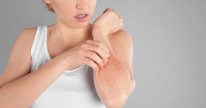 Grzybica skóry – przyczyny, objawy, leczenie dermatofitozy i drożdżycy skóry