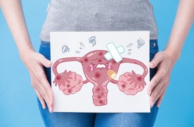 Rak endometrium – przyczyny, objawy, rokowania