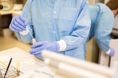 Oznaczanie amoniaku w moczu