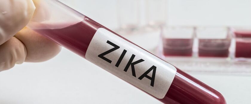 Wirus Zika: ciężarne zarażone w USA