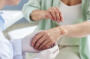 trądzik odwrócony, acne inversa, leczenie trądziku odwróconego