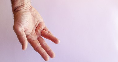 Przykurcz Dupuytrena – przyczyny, objawy, leczenie przykurczu rozcięgna dłoniowego