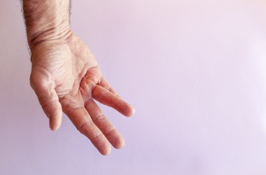 Przykurcz Dupuytrena – przyczyny, objawy, leczenie przykurczu rozcięgna dłoniowego