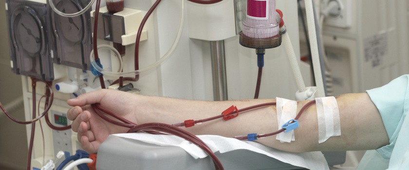 W jaki sposób hemodializa może pomóc chorym na Covid-19?