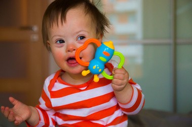 Zespół Downa – przyczyny, objawy, diagnoza wady wrodzonej płodu. Postępowanie lecznicze po rozpoznaniu trisomii 21