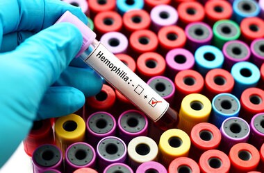 Hemofilia – przyczyny, objawy, leczenie, zalecenia dla chorych