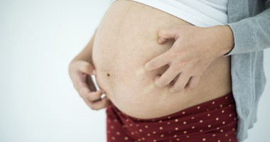 Co może oznaczać swędzenie skóry w ciąży?