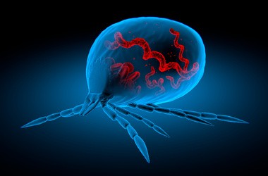 Borelioza – objawy, przyczyny diagnostyka, leczenie choroby z Lyme