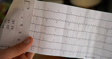 Wynik elektrokardiogramu