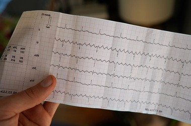 Wynik elektrokardiogramu