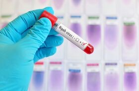 test diagnostyczny na obecnosć wirusa nipah, wirus nipah w Indiach, wirus nipah 2026
