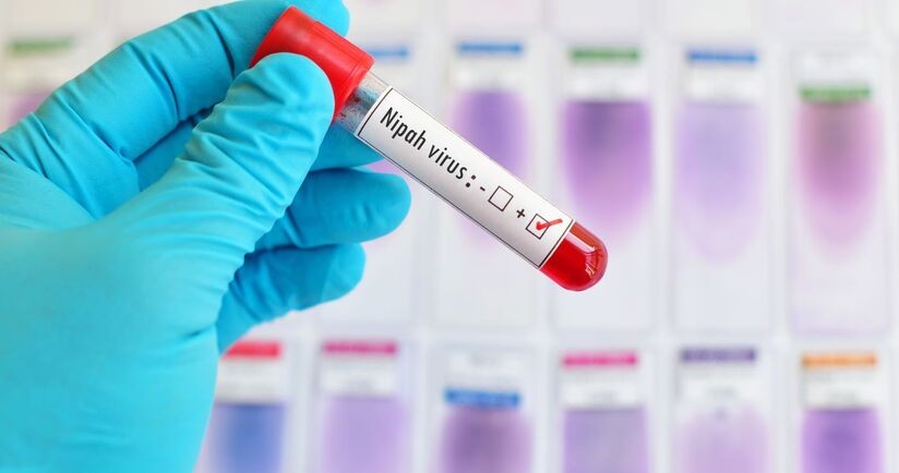 test diagnostyczny na obecnosć wirusa nipah, wirus nipah w Indiach, wirus nipah 2026