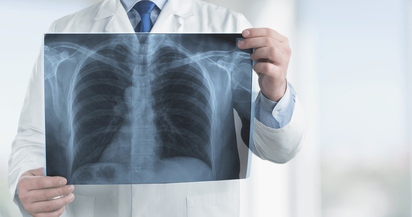 POChP – przyczyny, objawy, leczenie, rokowania w przewlekłej obturacyjnej chorobie płuc