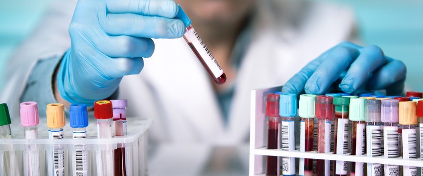 statyw na próbki krwi do badania krwi w kierunku nowotworów