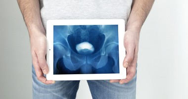 Czym się objawia przerost prostaty i jak go wyleczyć?