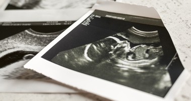 USG wczesnej ciąży — co zobaczymy w pierwszych tygodniach i jak to interpretować?