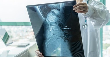 Rozszczep kręgosłupa – na czym polega spina bifida? Jak wyglądają leczenie i rehabilitacja osób z rozszczepem kręgosłupa?