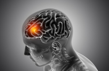 Szybka diagnostyka groźnego guza mózgu dzięki badaniu krwi? Powstała nowa metoda wykrywania glejaka