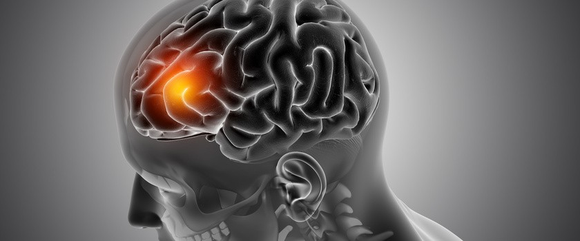 Szybka diagnostyka groźnego guza mózgu dzięki badaniu krwi? Powstała nowa metoda wykrywania glejaka