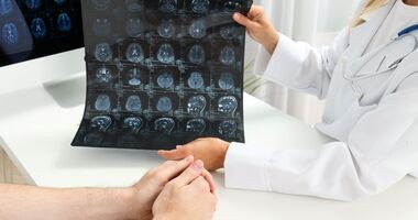 Lekarka pokazuje pacjentowi wynik badania MRI. Glejak mózgu, glejak wielopostaciowy, glejak iv stopnia