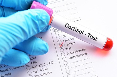 Kortyzol – norma, badanie, objawy podwyższonego i obniżonego kortyzolu