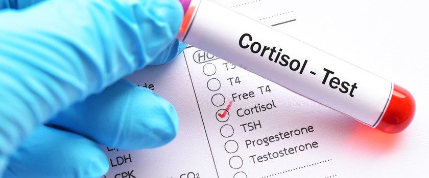Kortyzol - norma, badanie, objawy podwyższonego i obniżonego kortyzolu