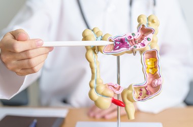 Zespół jelita drażliwego prezentowany na modelu jelita przez lekarza