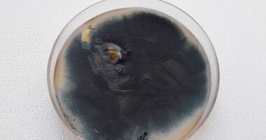 Pleśń Aspergillus fumigatus w laboratorium