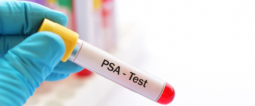 Badanie antygenu tPSA (wolny) i PSA – wskazania, przebieg, normy