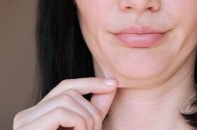 skóra twarzy pod odchudzaniu, ozempikowa twarz, obwisła skóra na twarzy kobiety