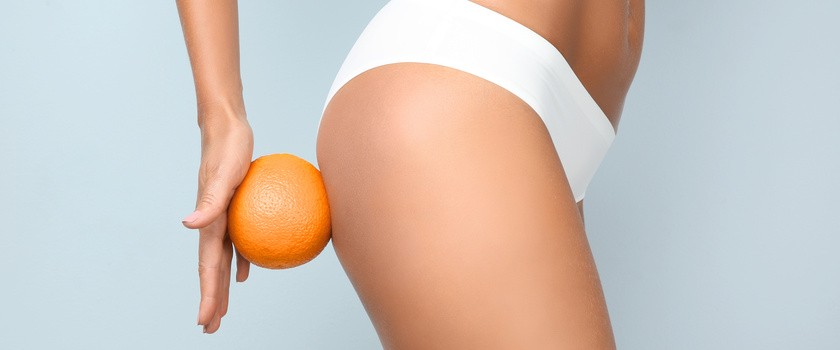 Defekt pomarańczowej skórki