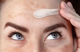 arbutyna, kosmetyki z arbutyną, arbutyna na przebarwienia, kobiec a twarz z przebarwieniami stosuje krem z arbutyną