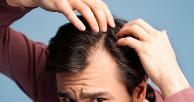 dieta na wypadanie włosów, wypadanie włosów, mężczyzna przeczesuje włosy