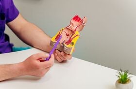 Medyk trzymający model odbytu, najczęstsze choroby odbytu.