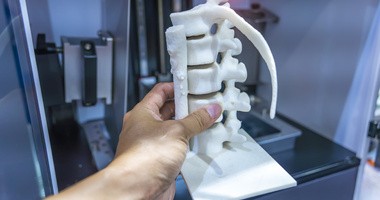 Czym są ortopedyczne implanty custom-made? Jak powstają protezy „szyte na miarę”?