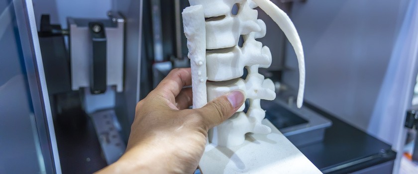 Czym są ortopedyczne implanty custom-made? Jak powstają protezy „szyte na miarę”?